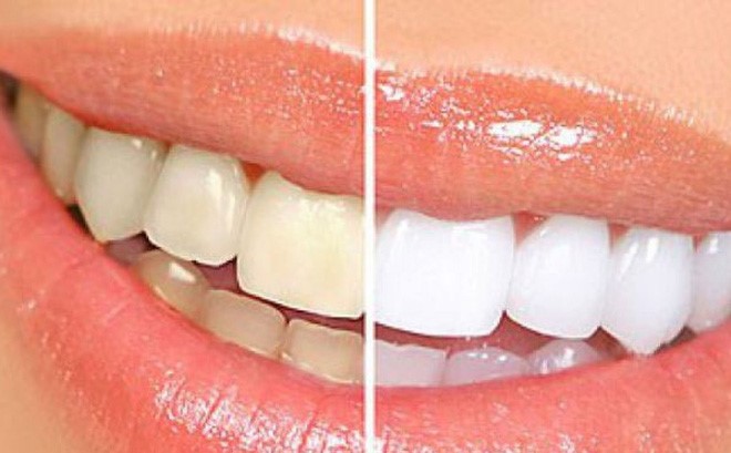 NHA KHOA TẠI QUẬN 10 NHA KHOA TẠI QUẬN 10